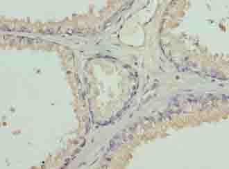 L3MBTL4 Antibody