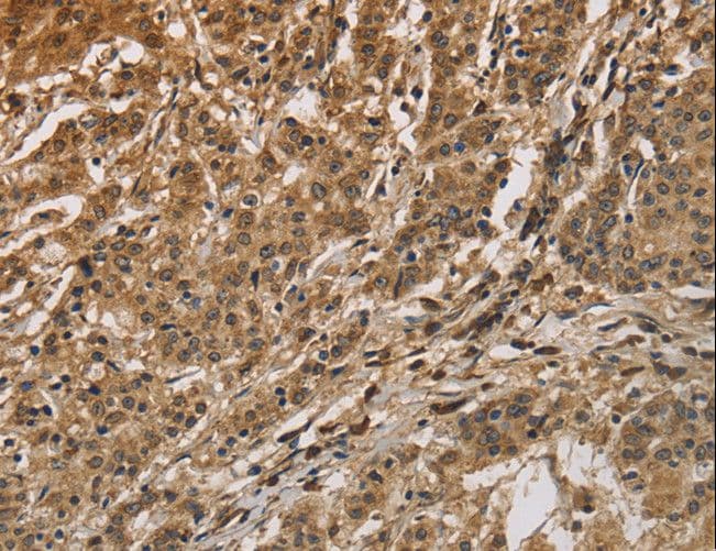 Polyclonal Rabbit anti-Human CALU / Calumenin Antibody (IHC, WB)