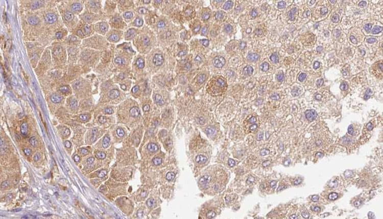 LTBP1 / LTBP-1 Antibody