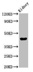 Polyclonal Rabbit anti-Human EAF2 / U19 Antibody (IHC, IF, WB)