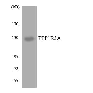 PPP1R3A / GM Antibody (aa632-681)