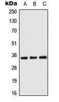 ACOT8 Antibody (Internal)