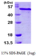 Human RCN2 Protein (Recombinant His)