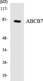 Polyclonal Rabbit anti-Human ABCB7 Antibody (aa680-729, IHC, WB)