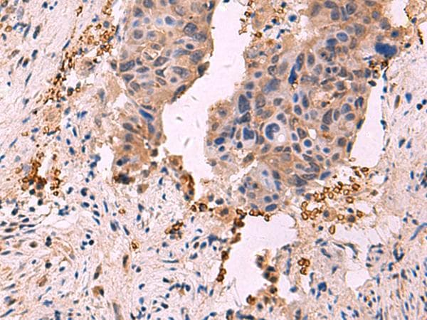 SHC4 Antibody