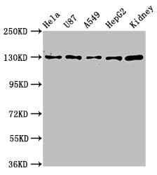 SLC12A2 / NKCC1 Antibody