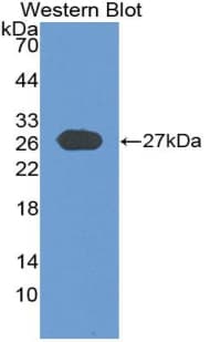 GP2 Antibody (aa301-506)