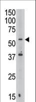 Polyclonal Rabbit anti-Human MAFK Antibody (aa57-85, IHC, WB)