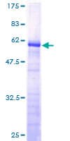 Human FAM84A Protein (Recombinant GST)