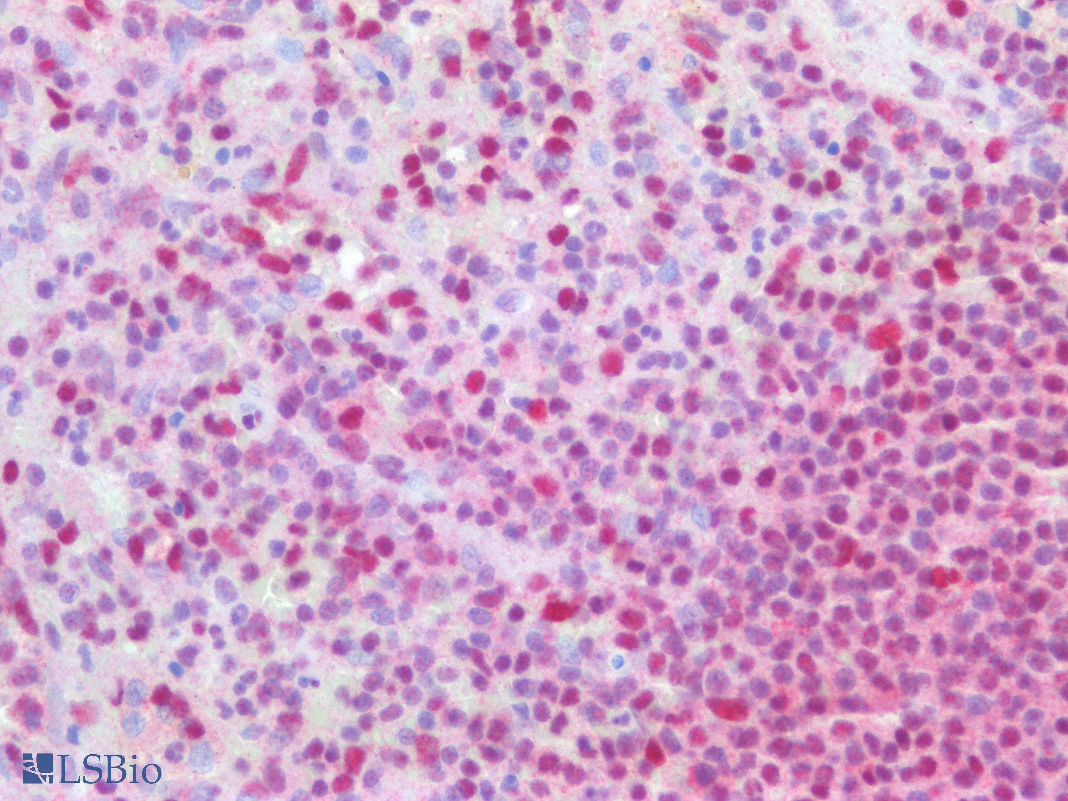 PathPlus™ Monoclonal Mouse anti-Human TFE3 Antibody (clone AHC0245, Ready-to-Use, IHC, WB)
