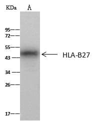 MHC Class I Antigen (HLA-B) Antibody (Preservative Free)