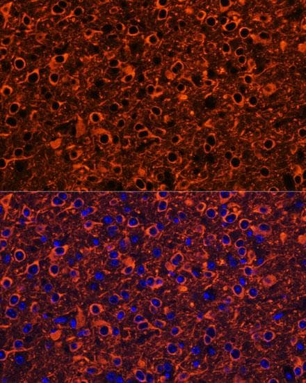 TUBB3 / Tubulin Beta 3 Antibody