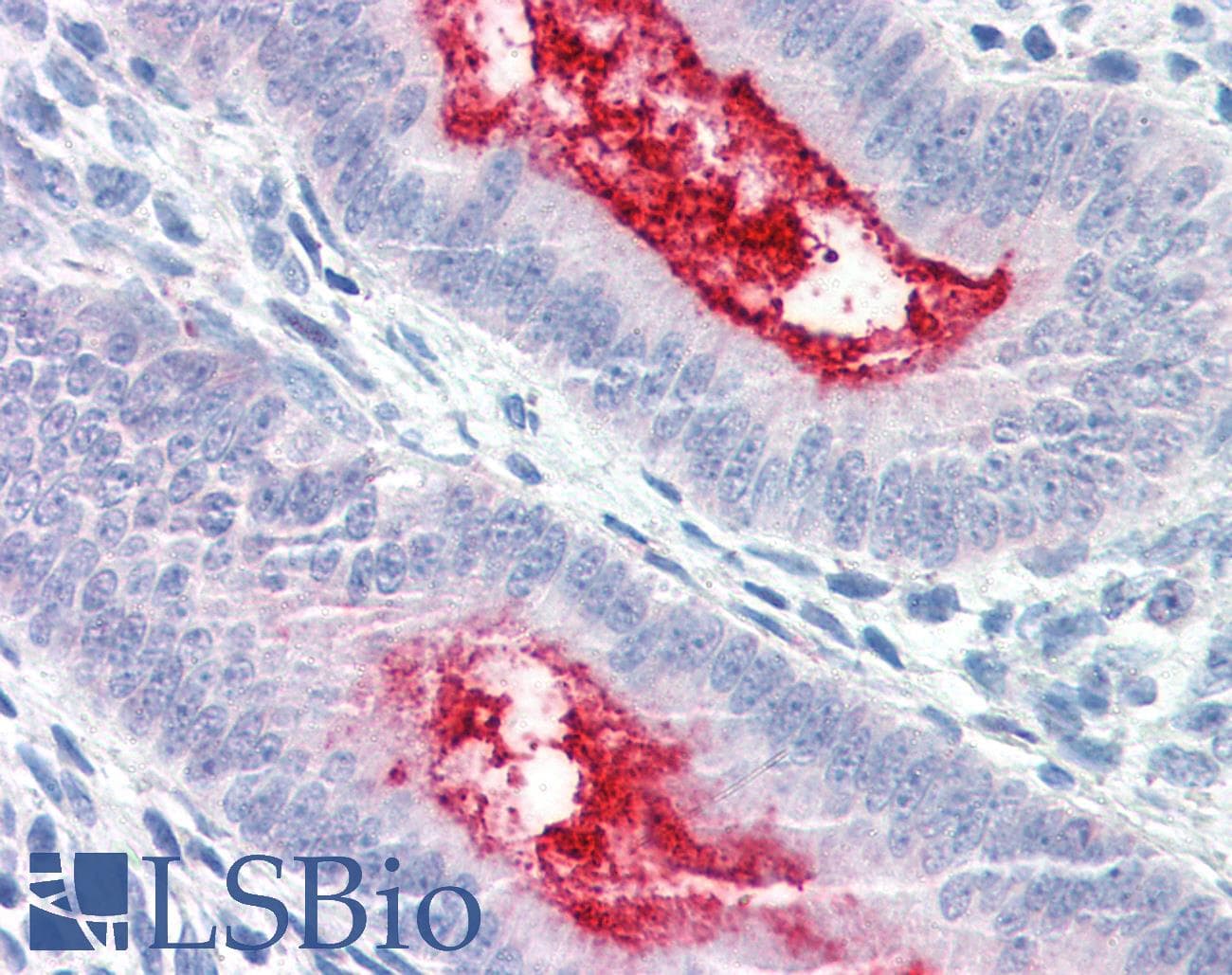 IHC-plus™ ENPP3 / CD203c Antibody (Internal)