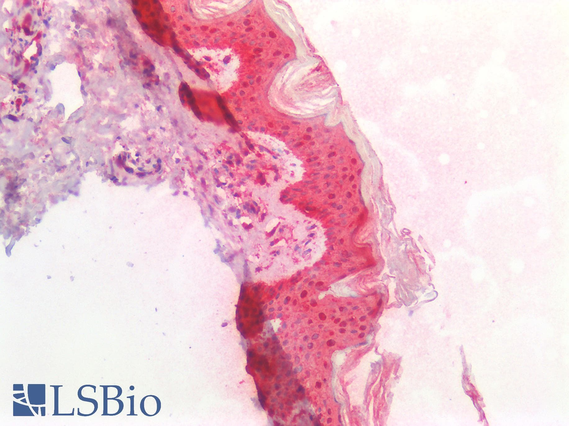 IHC-plus™ HSPB1 / HSP27 Antibody