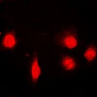 SH2B1 Antibody