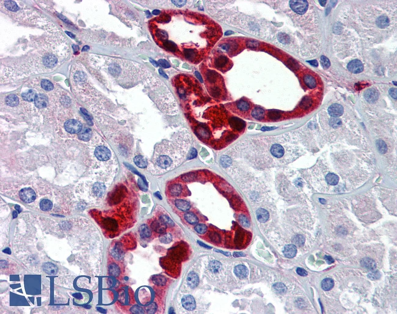 PathPlus™ UCHL1 / PGP9.5 Antibody (aa171-220)