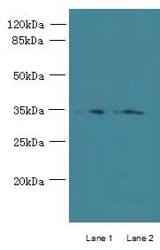 Polyclonal Rabbit anti-Human CCDC108 Antibody (Coiled-coil domain, IHC, WB)