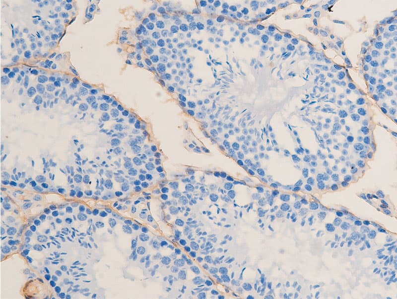 ACTA2 / Smooth Muscle Actin Antibody