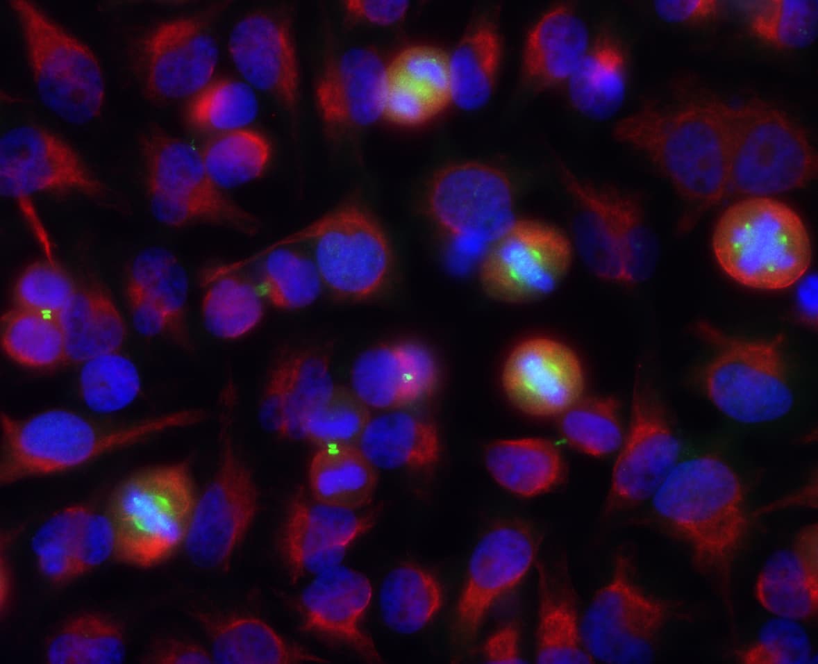 AURKA / Aurora-A Antibody (clone 3H1)