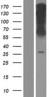 Human WLS / GPR177 Protein (Over-Expression Lysate Myc-DDK (Flag))