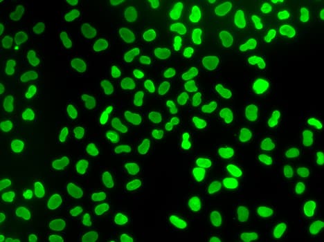 Polyclonal Rabbit anti-Human TMPO / TP / Thymopoietin Antibody (IHC, IF, WB)