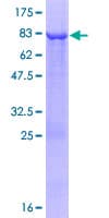 Human ARHGAP25 Protein (Recombinant GST)