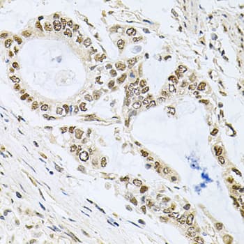 Polyclonal Rabbit anti-Human MCL1 / MCL 1 Antibody (IHC, IF, WB)