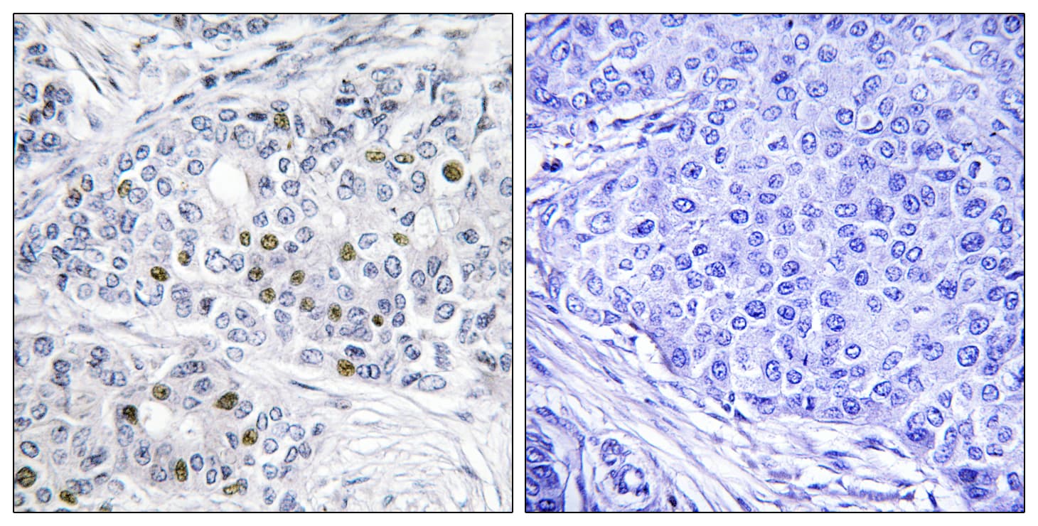 Polyclonal Rabbit anti-Human RB1 / Retinoblastoma / RB Antibody (aa791-840, IHC, IF)