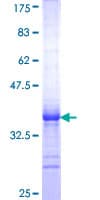 Human CLPS / Colipase Protein (Recombinant GST, N-terminus)
