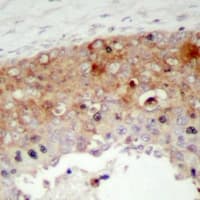 Polyclonal Rabbit anti-Human p66 / SHC Antibody (phospho-Tyr427, IHC, WB)