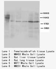 Cullin 4B / CUL4B Antibody