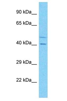 FAM73B Antibody (aa70-119)