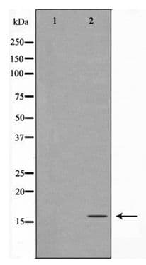 TOMM20 Antibody