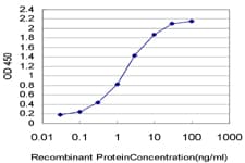 PathPlus™ SMC1A / SMC1 Antibody (clone 1B9)