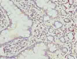 CRISPLD1 Antibody