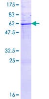 Human KLK7 / Kallikrein 7 Protein (Recombinant GST)