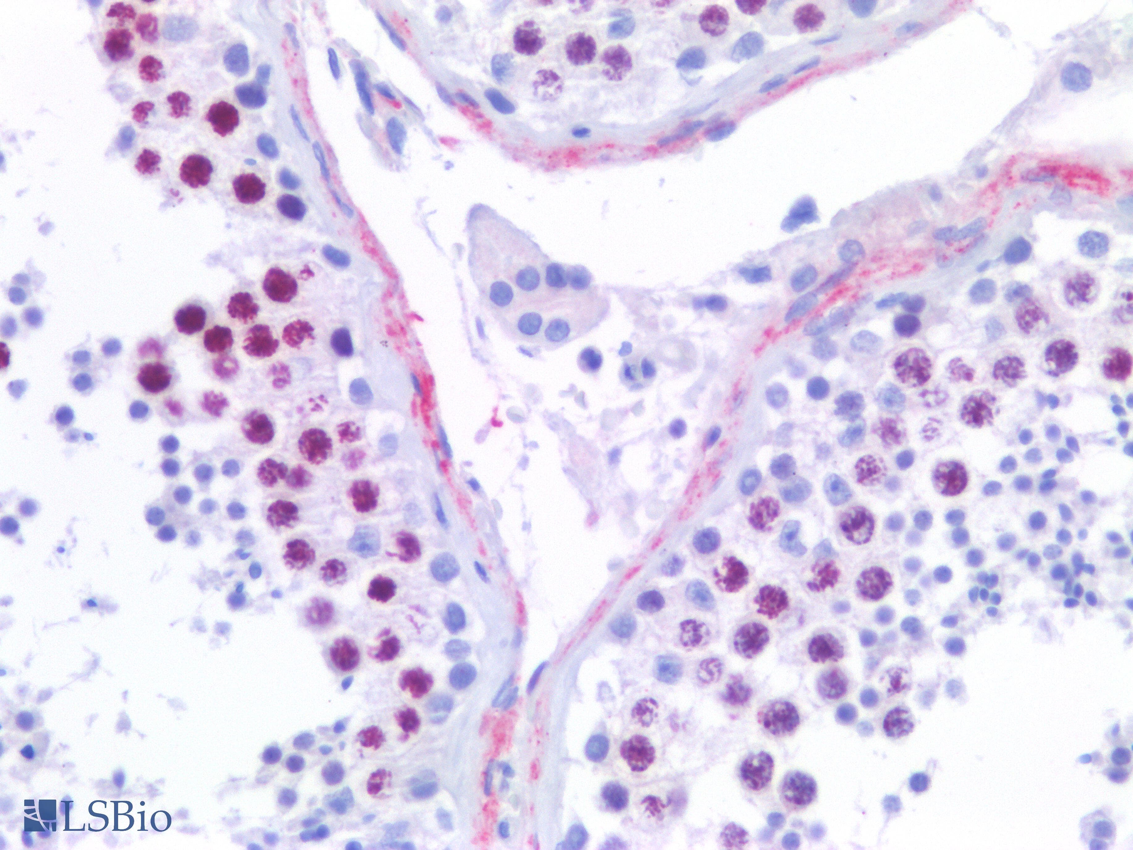 IHC-plus™ TOP2A / Topoisomerase II Alpha Antibody (N-Terminus)
