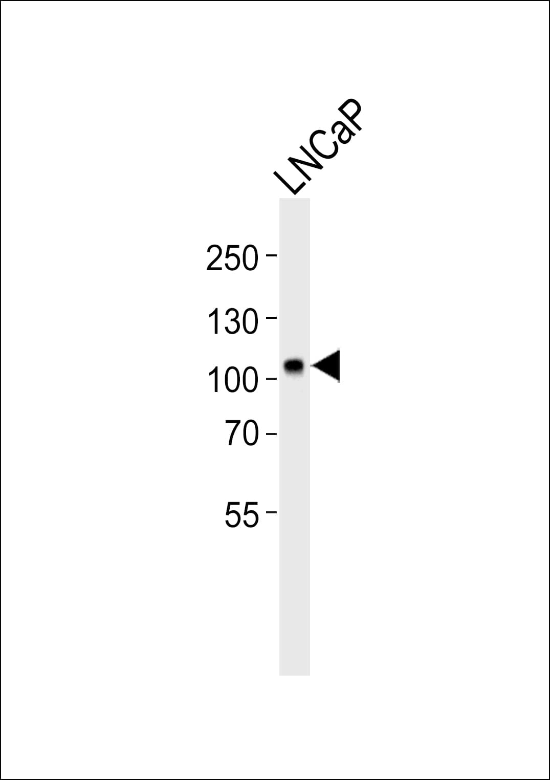 MME / CD10 Antibody (aa99-132)