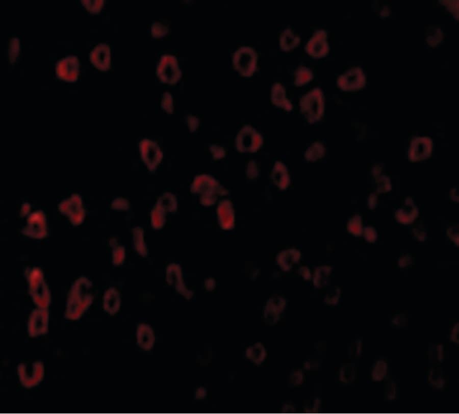 IHC-plus™ Polyclonal Rabbit anti-Human KITLG / SCF Antibody (IHC, IF, WB)