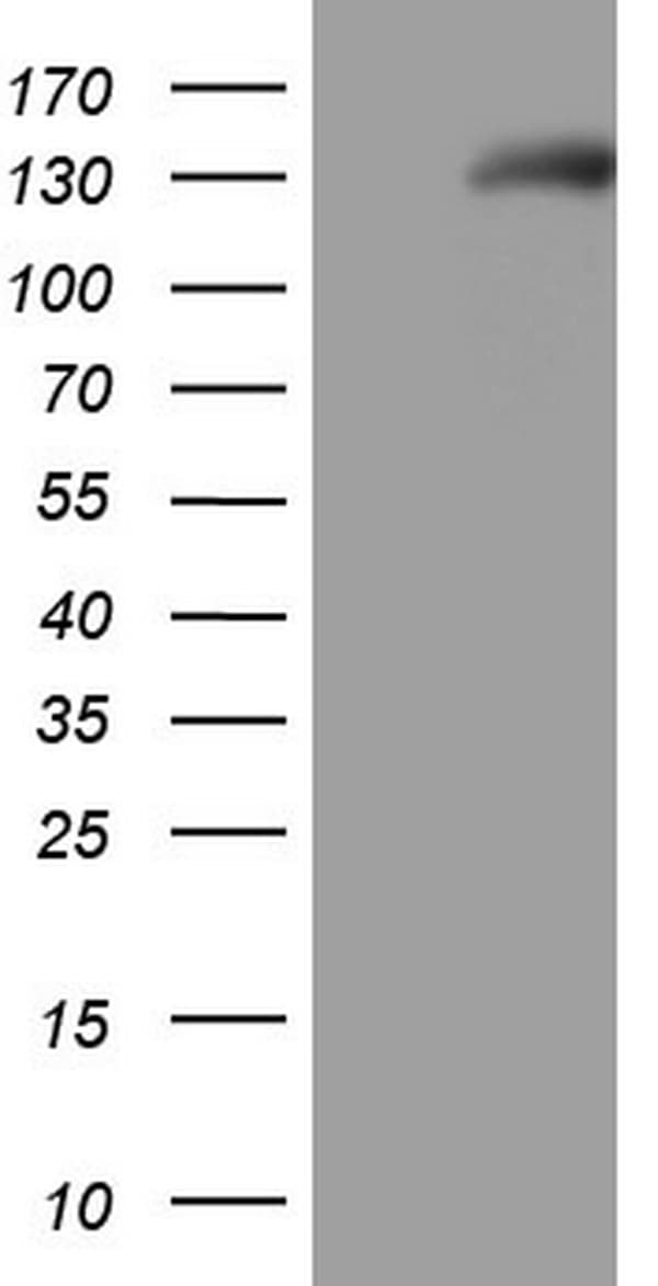 NPRA / NPR1 Antibody (aa746-1006, clone OTI7H7)