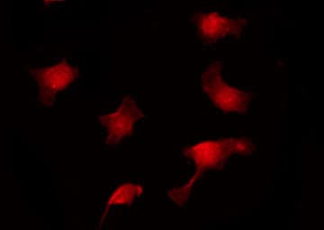 APC Antibody (phospho-Ser2054)