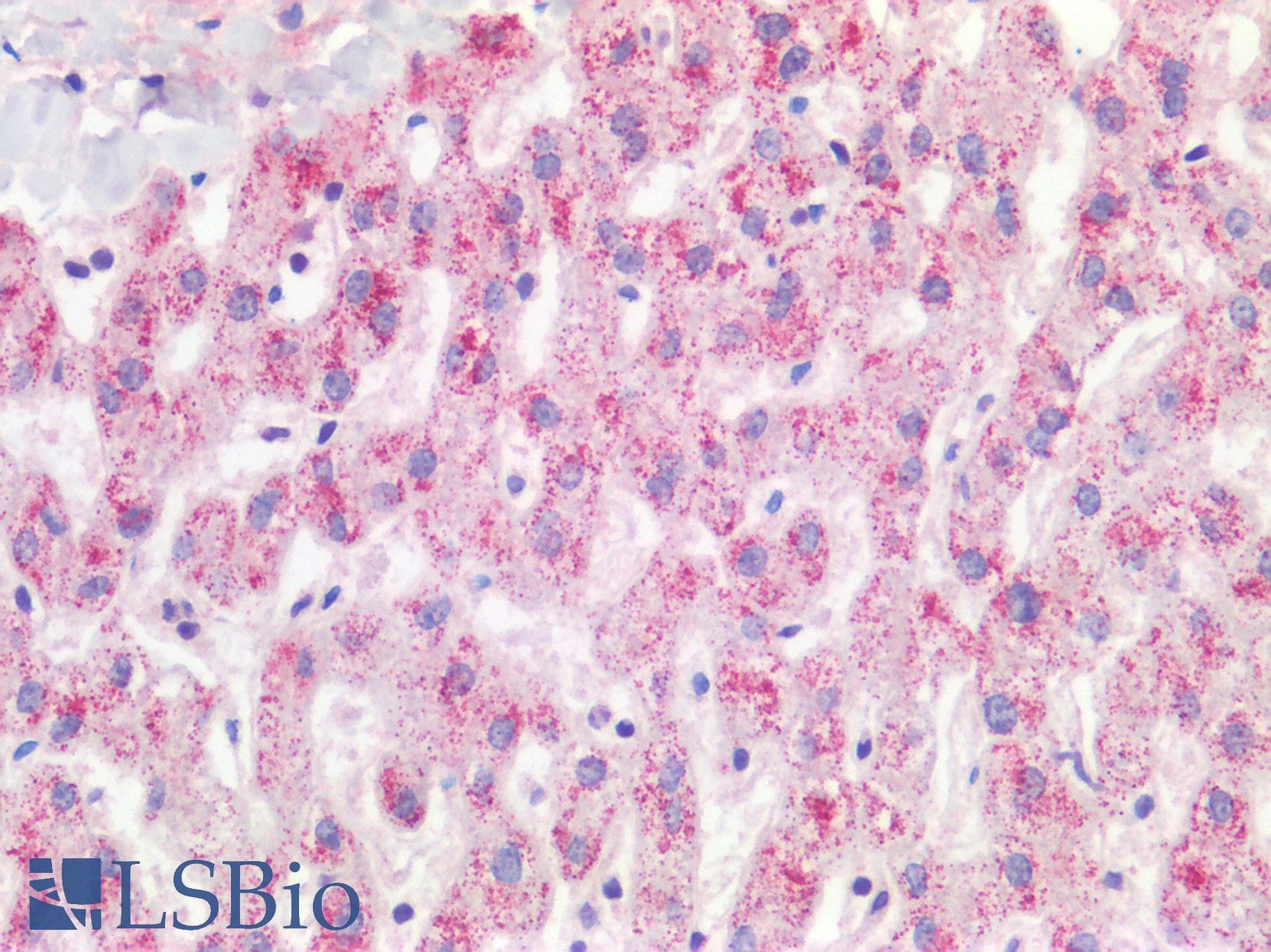 IHC-plus™ Polyclonal Rabbit anti-Human ACOX1 / ACOX Antibody (IHC, WB)