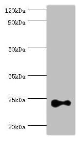 RAB4A / RAB4 Antibody (aa1-218)