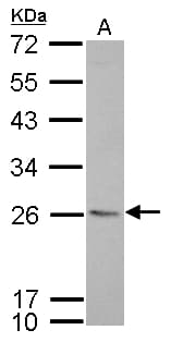 IHC-plus™ CD74 / CLIP Antibody (aa1-58)