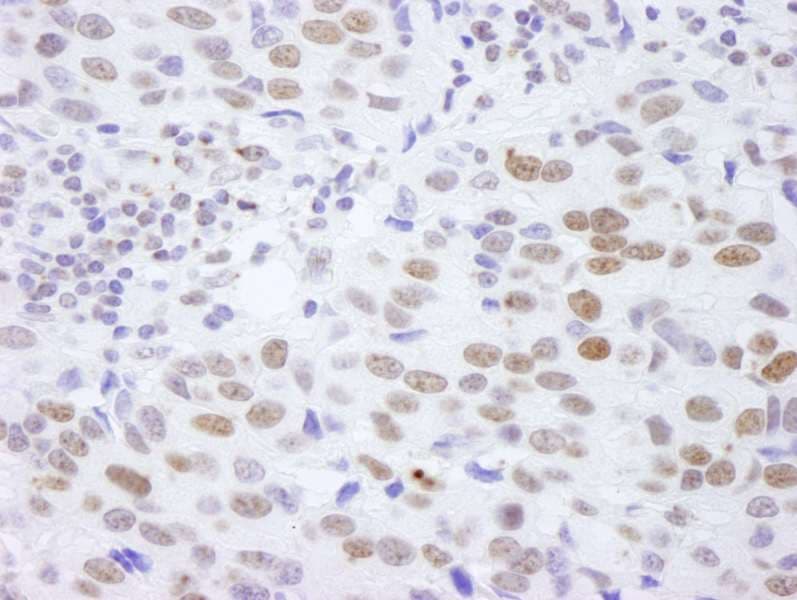 Polyclonal Rabbit anti-Human HIST1H4I Antibody (aa50-C-term, IHC)