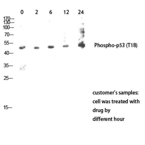 TP53 / p53 Antibody (1-80 aa)