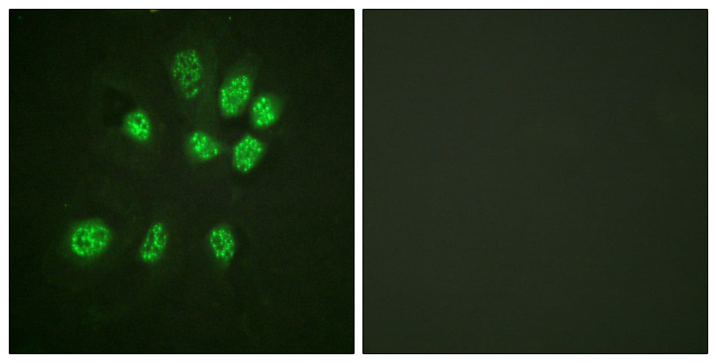 Polyclonal Rabbit anti-Human ESR2 / ER Beta Antibody (aa71-120, IF, WB)