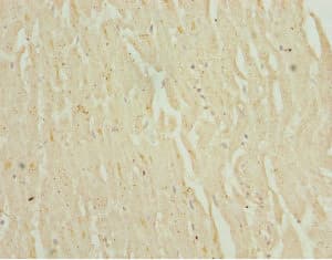 MALIN / NHLRC1 Antibody