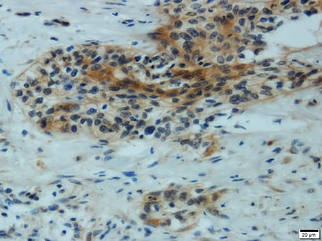 Polyclonal Rabbit anti-Human MMP1 Antibody (IHC, WB)