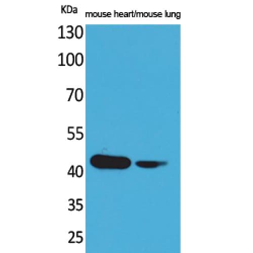 IHC-plus™ ACTC1 / Alpha Cardiac Actin Antibody (1-80 aa, N-terminal)